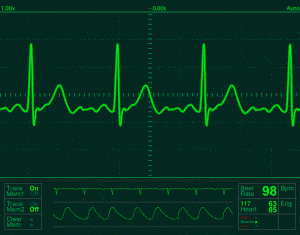 Elettrocardiogramma